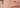 Sensitive vs Sensitized Skin