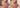 V-Lift: Benefits + Our Most FAQ - by Kin Aesthetics