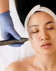 Nano + Micro-needling Tips - by Kin Aesthetics