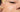A Quick Guide: Nano vs Micro-needling - by Kin Aesthetics