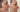 V-Lift: Benefits + Our Most FAQ - by Kin Aesthetics