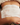 KrX Carboxy Therapy Full Body Kit - by Kin Aesthetics 
