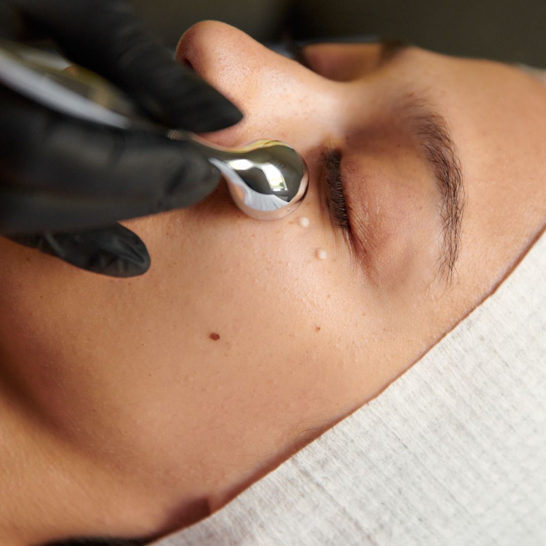 Arctic Eye roller | Kin Aesthetics