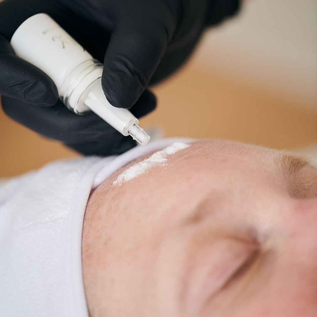 KrX HA Filling Powder - by Kin Aesthetics