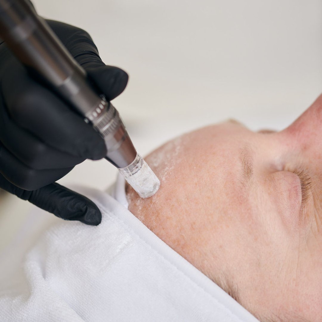 KrX HA Filling Powder - by Kin Aesthetics