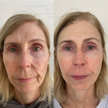 KrX Youthplex Face Lift Serum - by Kin Aesthetics 